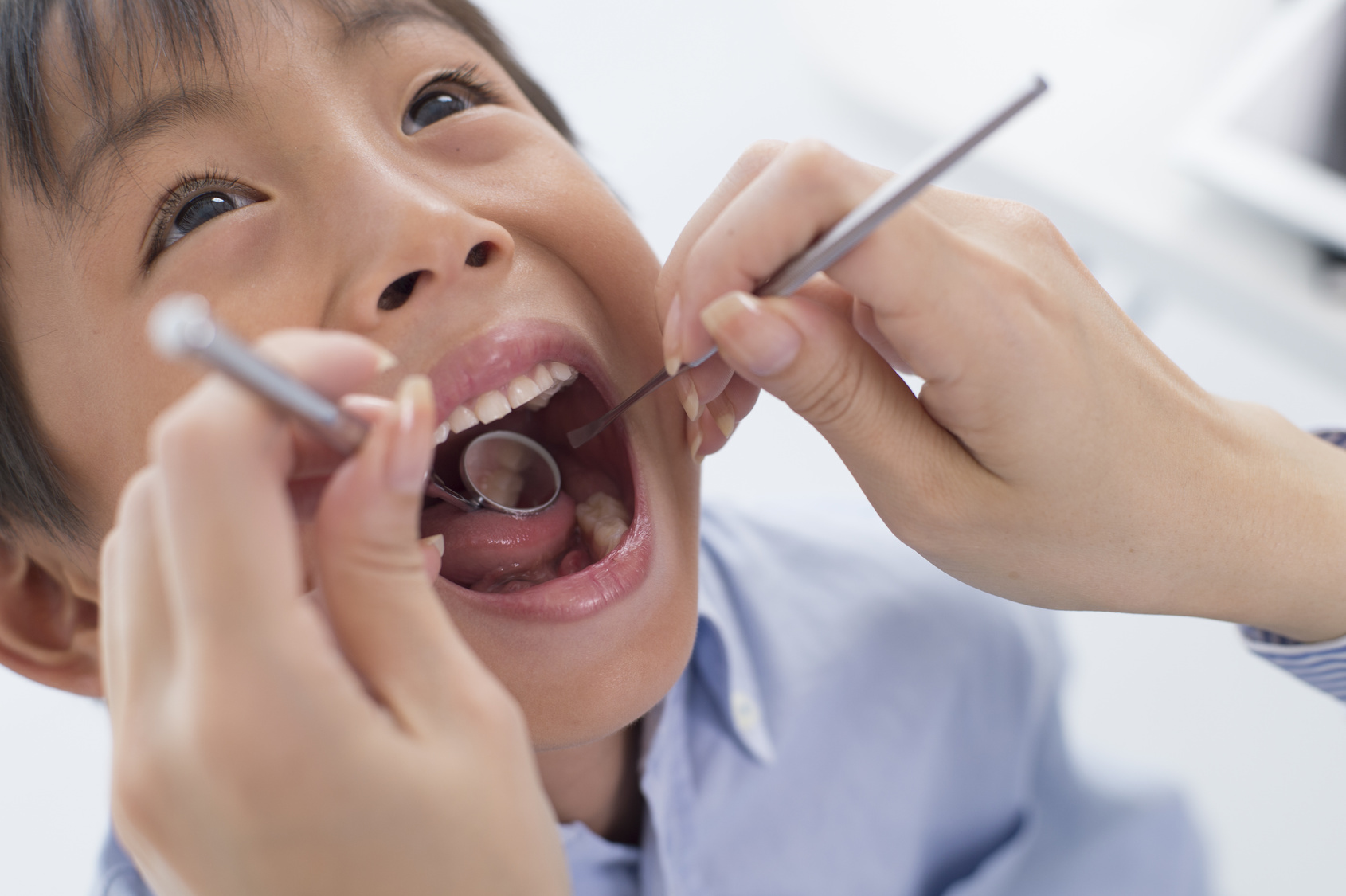 歯の診察を受ける子ども